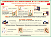 Таблица Порядок действий при опасном кровотечении 1000*1400 винил - «globural.ru» - Сургут